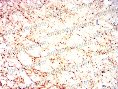 Валидация AntibodySystem RHF56704 (2570)