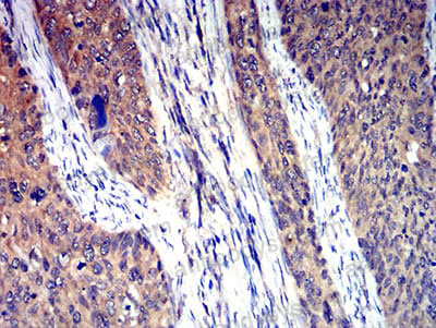 Валидация AntibodySystem RHE47404