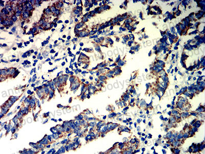 Валидация AntibodySystem RHD65401