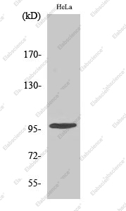 Вестерн-блоттинг, Phospho-CHEK2 (Thr68), клетки HeLa