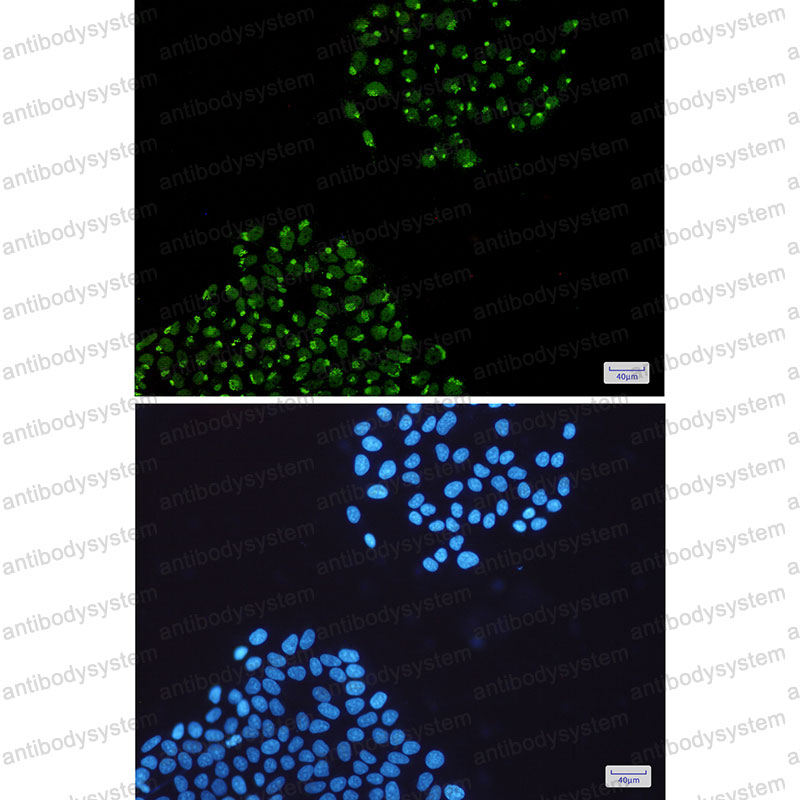 Валидация IF - AntibodySystem RHA93201