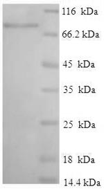 SDS-PAGE