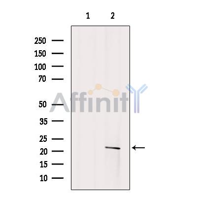Валидация Affinity DF9845 - 22750