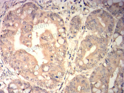 Валидация AntibodySystem RHH11502 (3181)