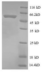 SDS-PAGE
