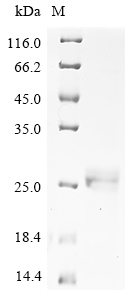 SDS-PAGE
