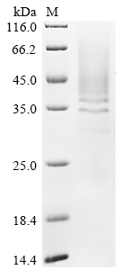 SDS-PAGE