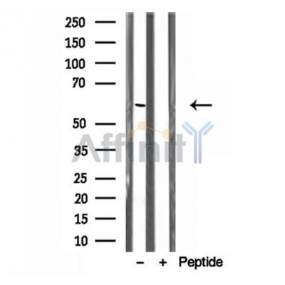 Валидация Affinity DF12140 - 6315