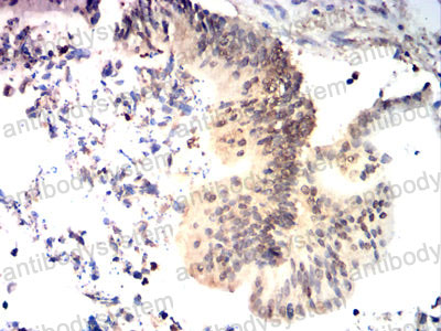 Валидация AntibodySystem RHF98202 (2763)