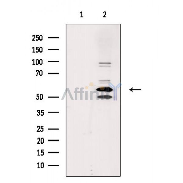 Валидация Affinity DF10027 - 5476
