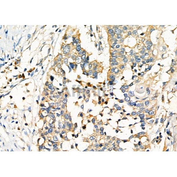 Валидация Affinity DF9500 - 22124