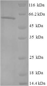 SDS-PAGE
