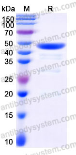 YHD05202, SDS-PAGE