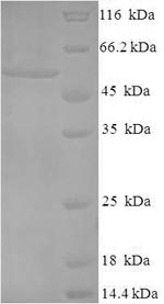SDS-PAGE