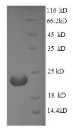 SDS-PAGE