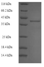 SDS-PAGE