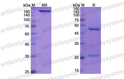Валидация SDS-PAGE - AntibodySystem DHD58802