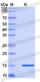 Валидация SDS-PAGE - AntibodySystem RHJ42201