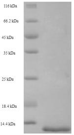 SDS-PAGE