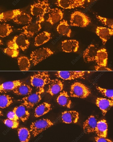 Иммунофлуоресценция, ACSL1, клетки NIH-3T3