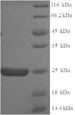 SDS-PAGE