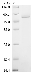 SDS-PAGE