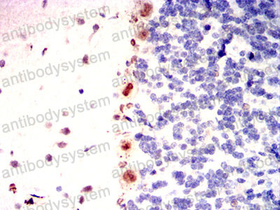 Валидация AntibodySystem RHE73902 (2298)