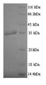 SDS-PAGE