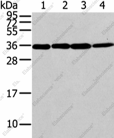 Вестерн-блоттинг, CBX7, клетки Lovo, 293T, Jurkat и HeLa