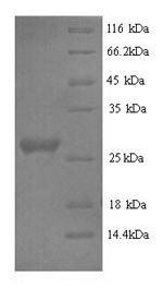 SDS-PAGE