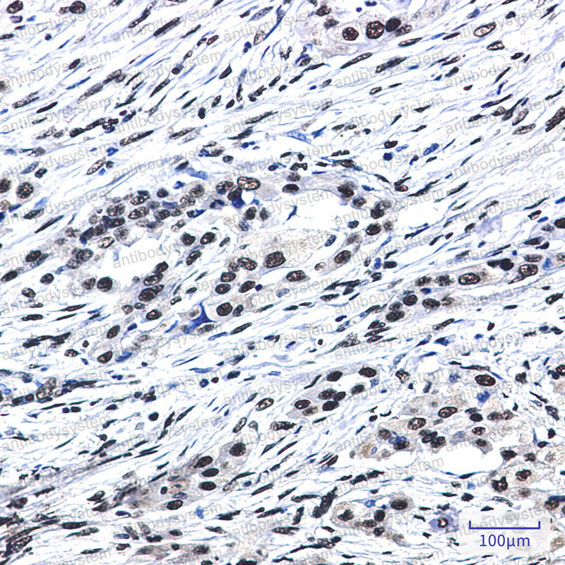 Валидация AntibodySystem RHB24001