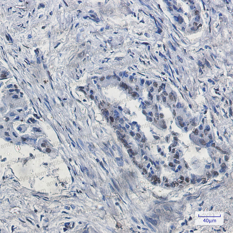 Валидация AntibodySystem RHB49604