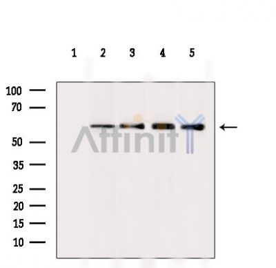 Валидация Affinity DF15539 - 11932