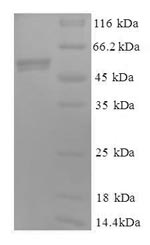 SDS-PAGE