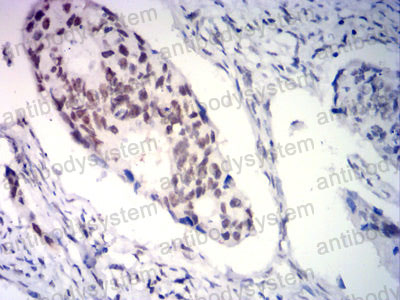 Валидация AntibodySystem RHC20003