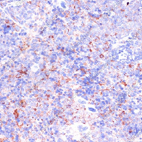 Иммуногистохимия, CD18, ткань селезенки мыши
