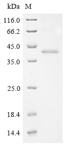 SDS-PAGE