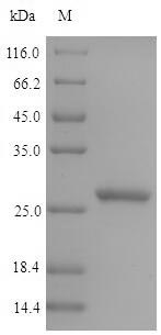 SDS-PAGE