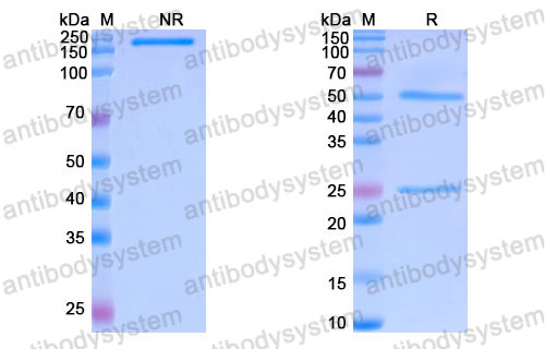 Валидация SDS-PAGE - AntibodySystem DHC35302