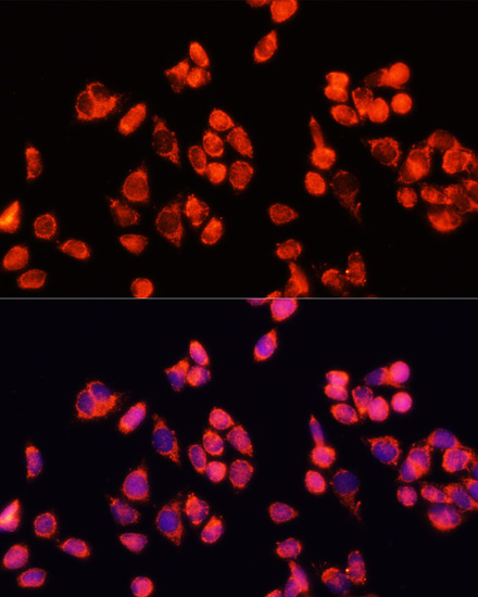 Иммунофлуоресценция, Angiopoietin 2, клетки HeLa
