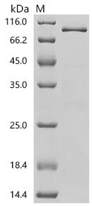 SDS-PAGE