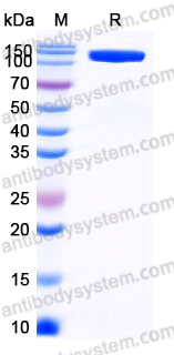 EHJ63801, SDS-PAGE