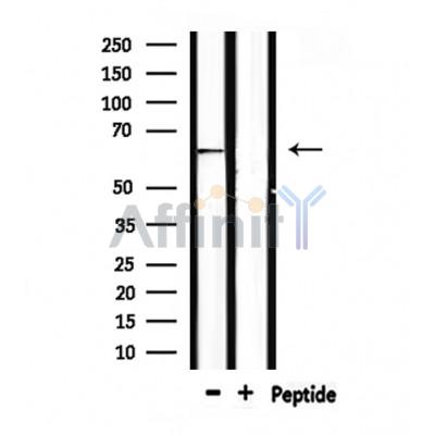 Валидация Affinity DF7021 - 18659