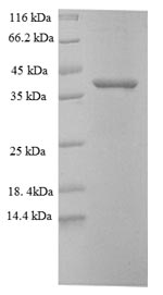 SDS-PAGE