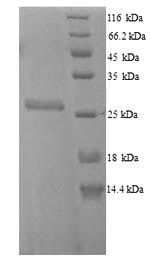 SDS-PAGE