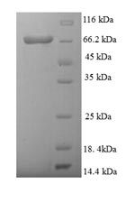 SDS-PAGE