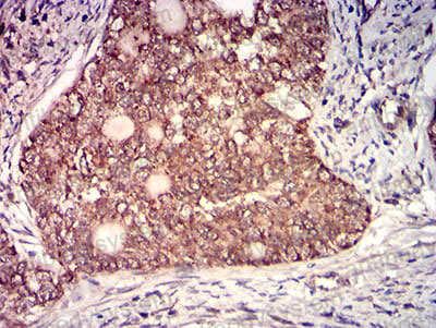 Валидация AntibodySystem RHE25302