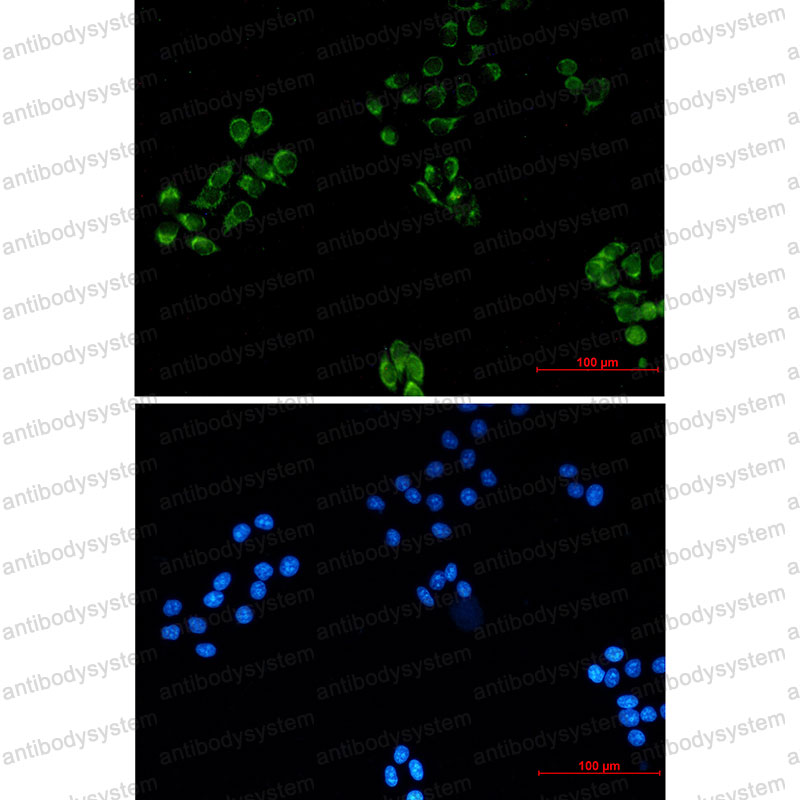 Валидация IF - AntibodySystem RHK36701