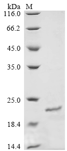 SDS-PAGE