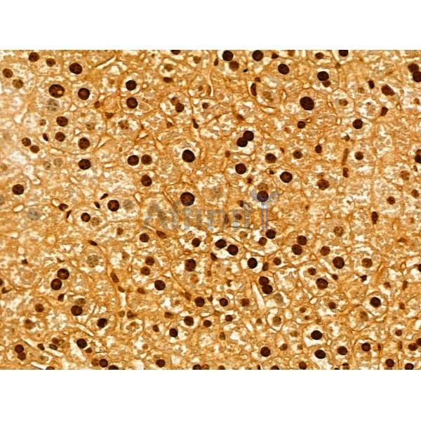 Валидация Affinity DF13061 - 7918